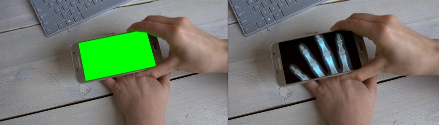Image left: close up of a hand holding a smartphone over another hand. The screen is bright green. Image right: Same as image left, but green is replaced with an image of X-rayed fingers, giving impression that the smartphone is X-raying the user's hand.